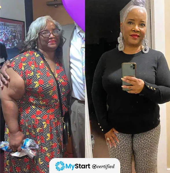 Before/After MyStart