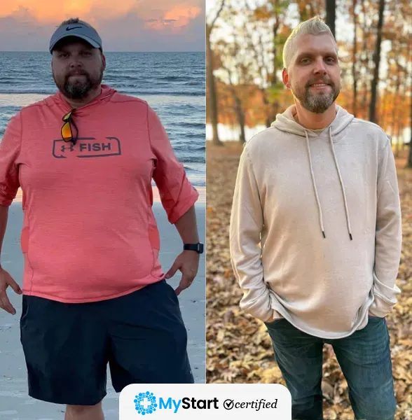 Before/After MyStart