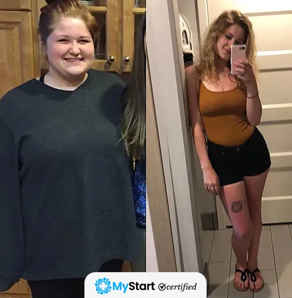 Before/After MyStart