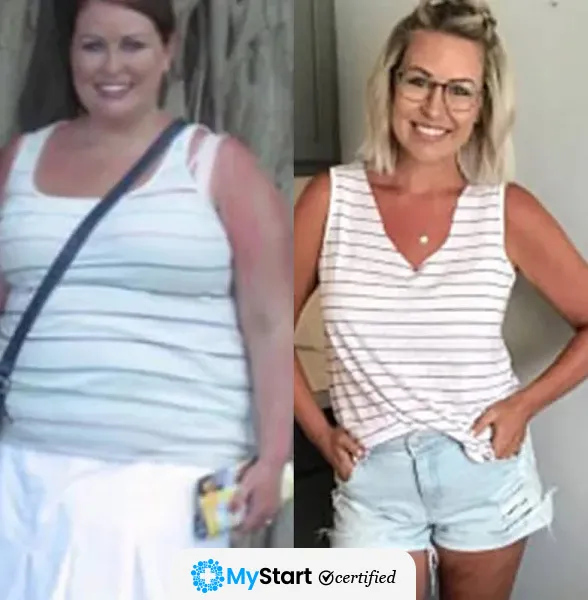 Before/After MyStart