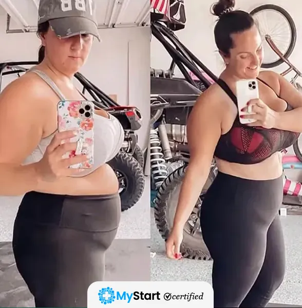 Before/After MyStart